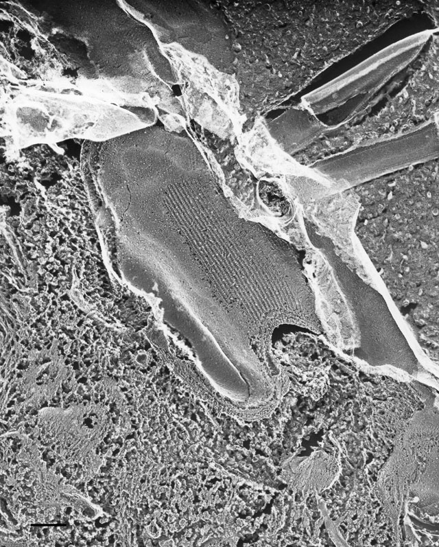 Chapter 1: Paramecium multimicronucleatum - Cortex and Cilia